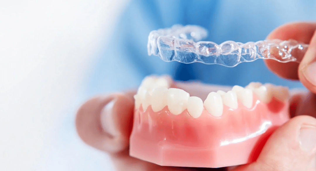 İnvisalign